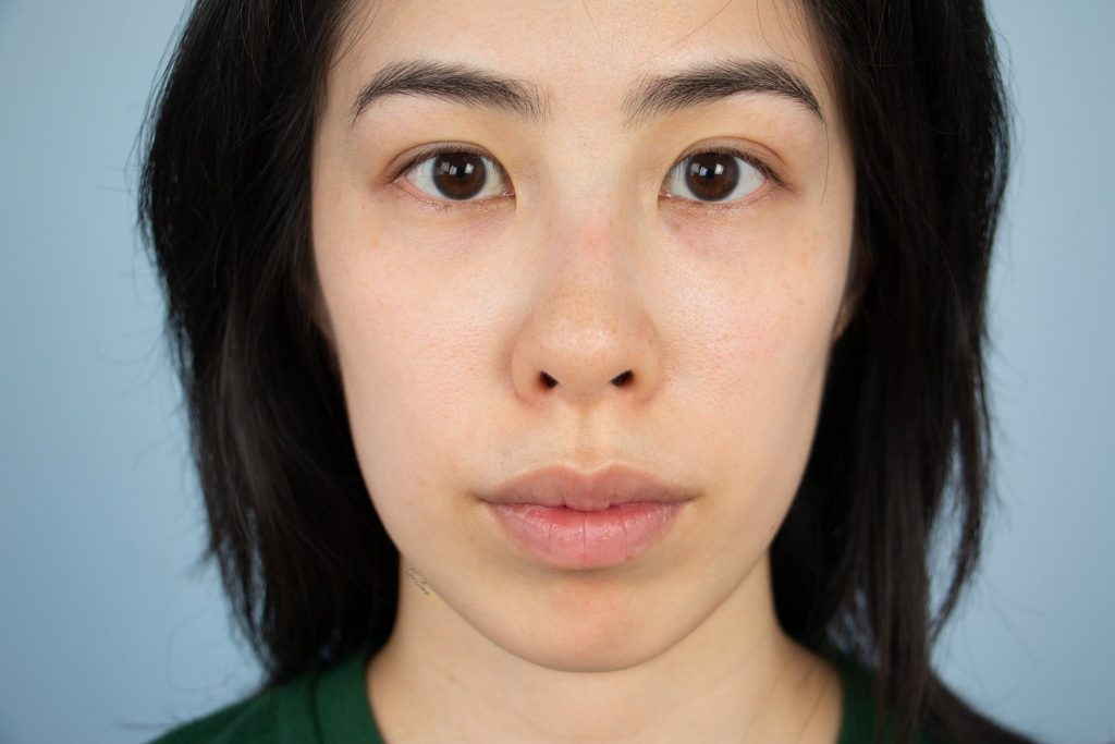How to get rid of eye bags shiatsu eye massage