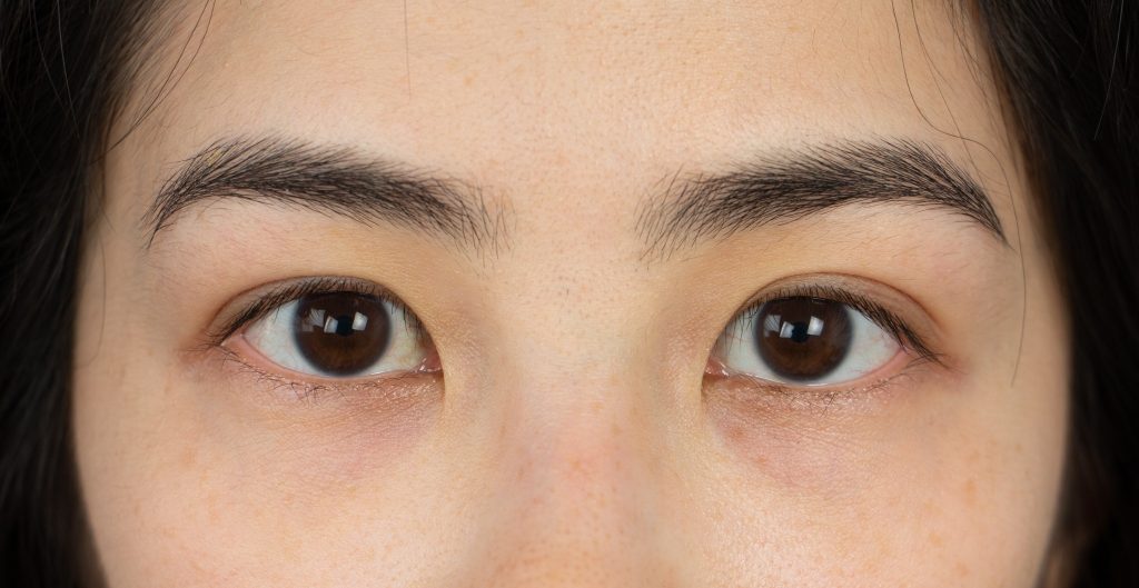 Benefits of shiatsu eye massage foreo iris review